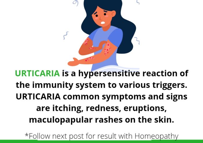 Skin allergy